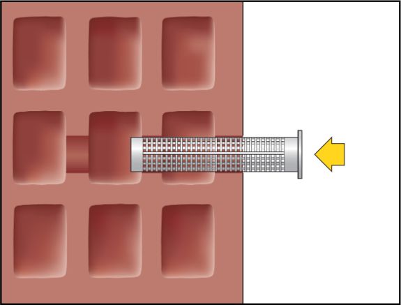 Imagen de montaje ResiFIX 15
