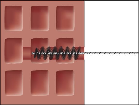 Imagen de montaje ResiFIX 12
