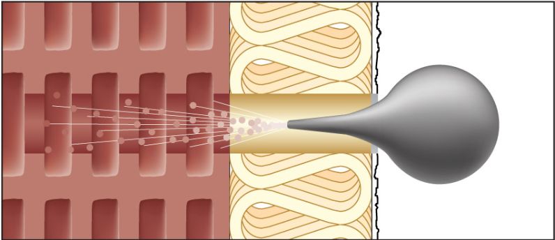 Imagen de montaje ResiTHERM 4