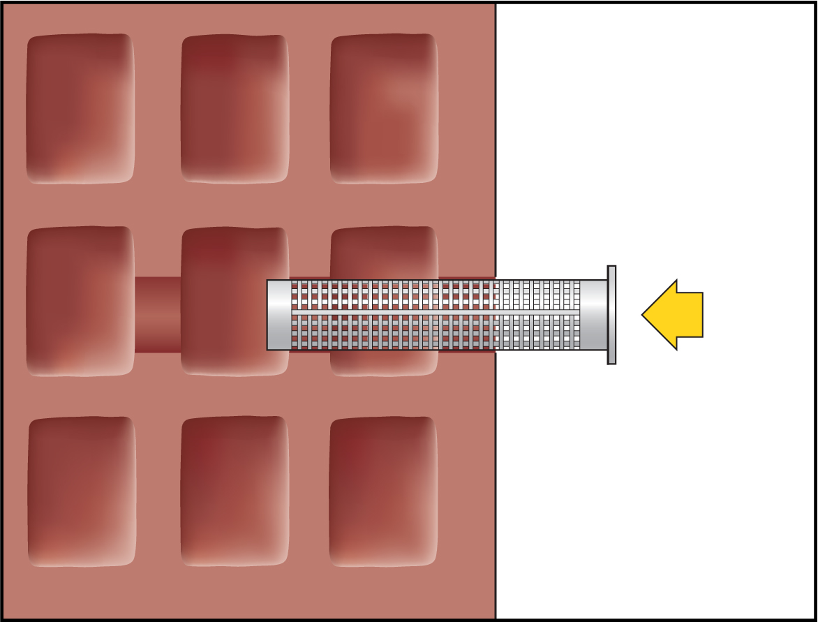 Imagen de montaje ResiFIX 15