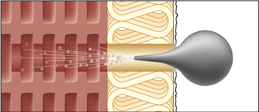 Imagen de montaje ResiTHERM 4