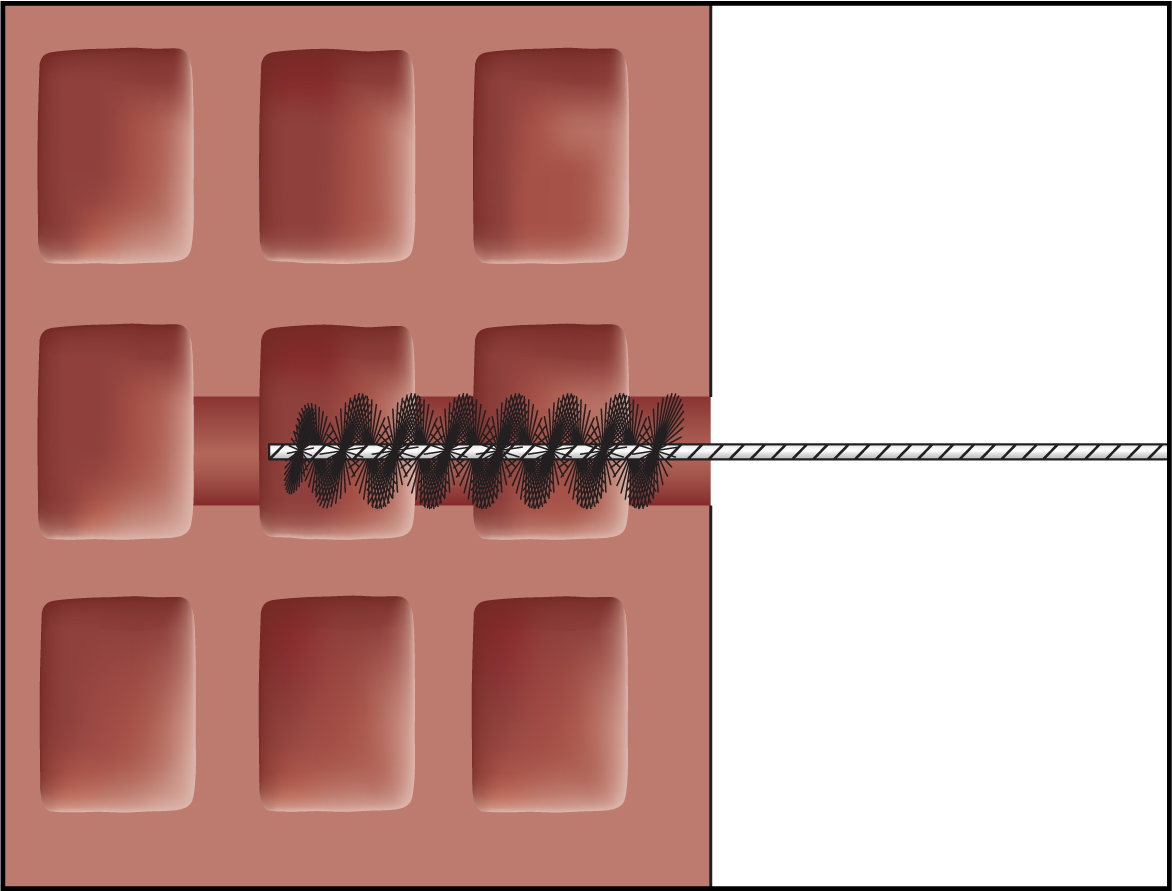 Imagen de montaje ResiFIX 12